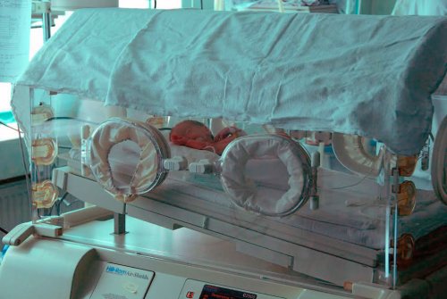 Peste 400 de copii cu malformații cardiace operați la „Marie Curie” Poza 52031
