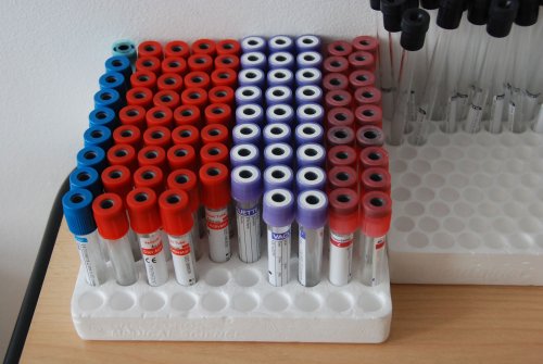 Testări gratuite pentru hepatitele B și C Poza 1638