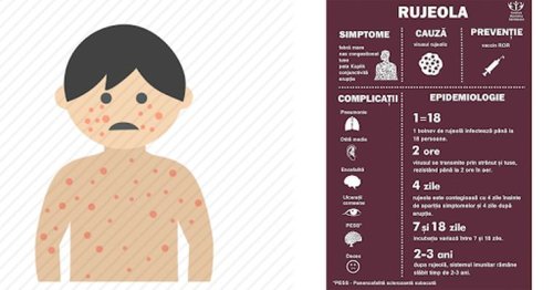 Noi cazuri de rujeolă în București și 9 județe Poza 138648