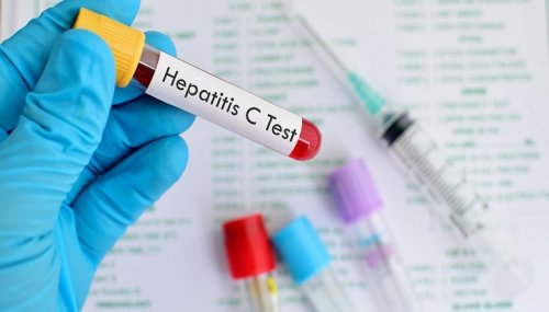 Tratamente fără interferon pentru pacienții cu hepatita C Poza 139135