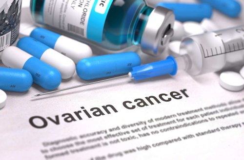 Cancerul ovarian, vindecabil în stadii incipiente Poza 171598