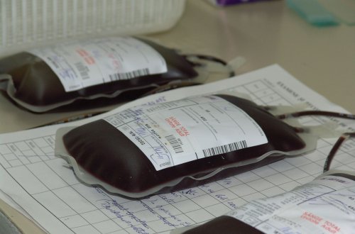 Rezerve de sânge și locuri în spitale pentru răniții din Ucraina Poza 204913