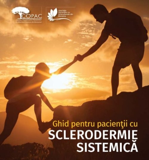Ghid pentru pacienții cu sclerodermie sistemică Poza 245414