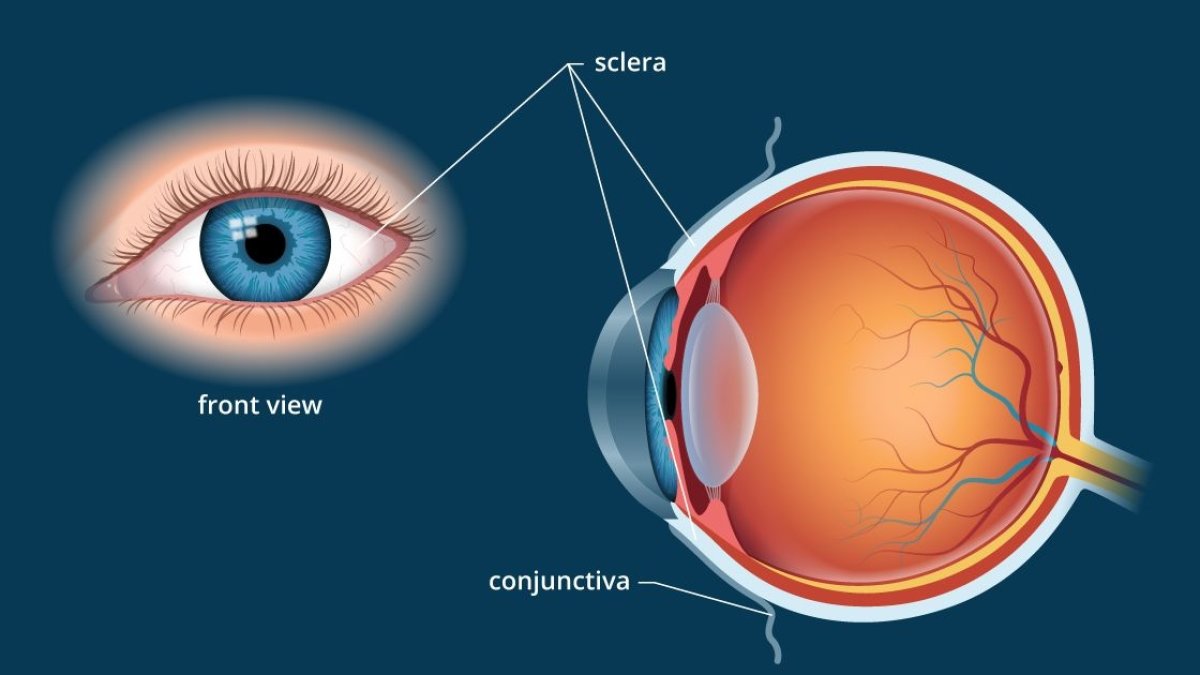 rezultatele examinărilor oculare viziunea a scăzut la 2