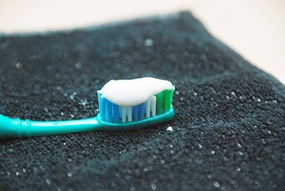 De ce apar anomaliile dentare