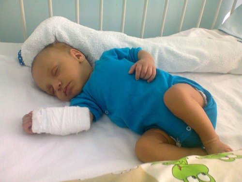 Un băieţel de 3 luni are nevoie de transplant de ficat