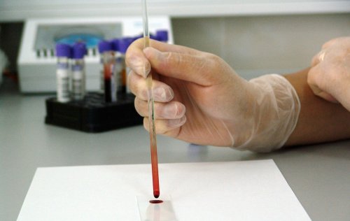 Teste rapide pentru diagnosticarea hepatitei C