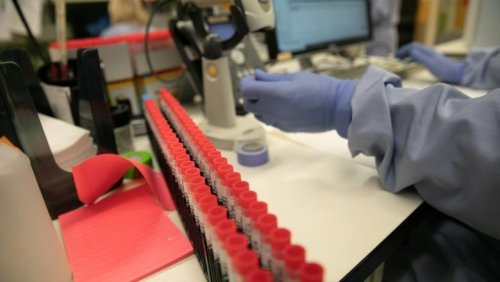 Testele care pot confirma infectarea cu noul coronavirus