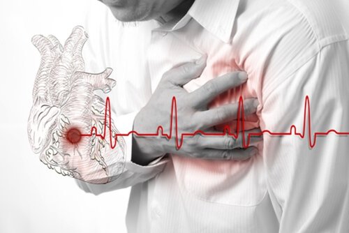 Gerul crește riscul de infarct miocardic