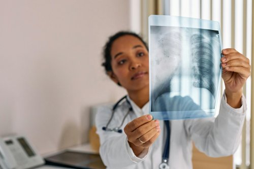 Hipertensiunea pulmonară, o urgență medicală
