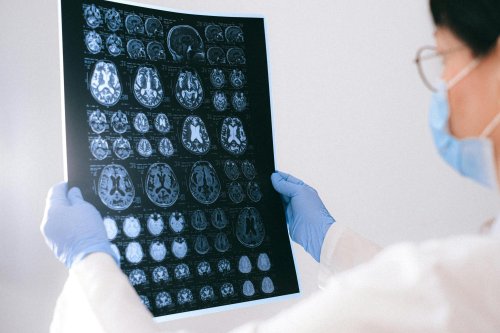 Neuronii se formează şi la bătrâneţe